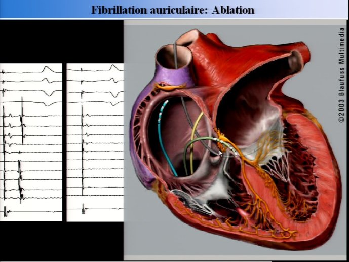 slide_0081_full