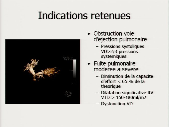 slide_0145_full