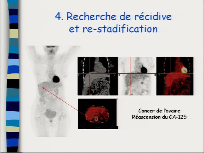 slide_0031_full