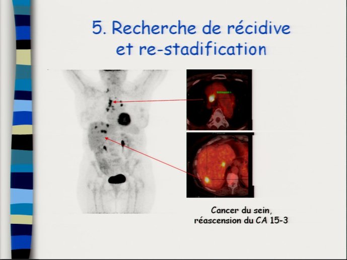 slide_0032_full