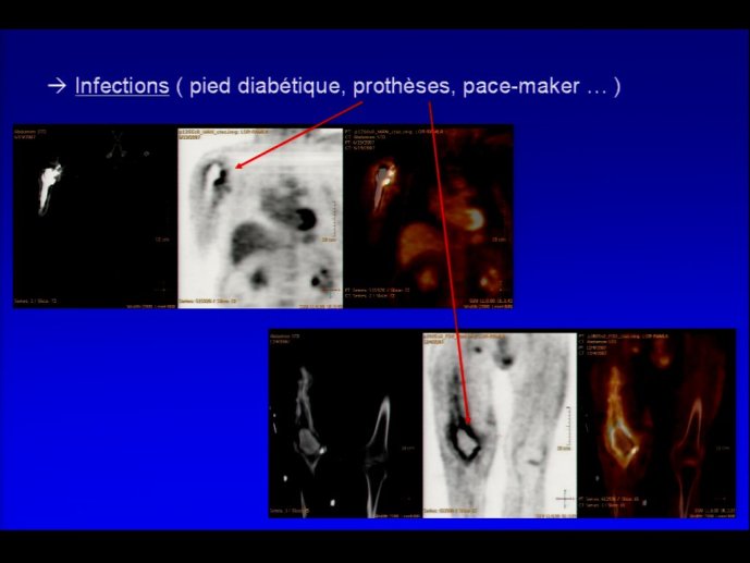 slide_0076_full