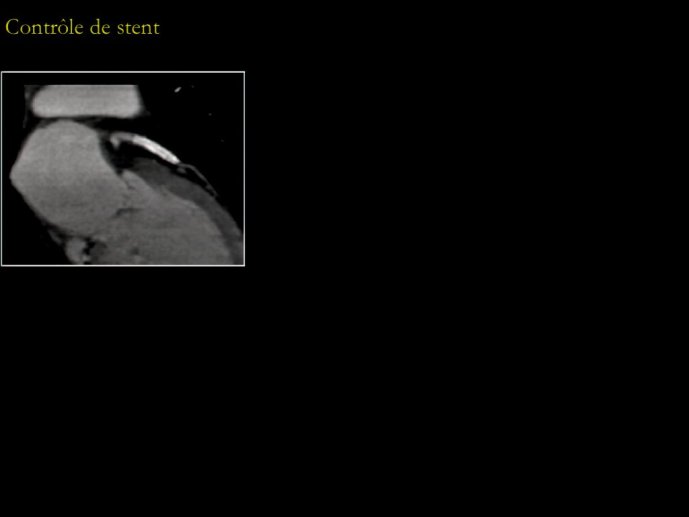 slide_0149_full