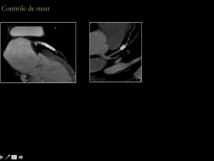 slide_0150_full