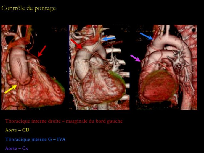 slide_0154_full