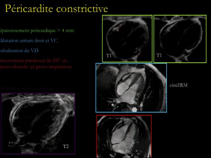 slide_0194_full