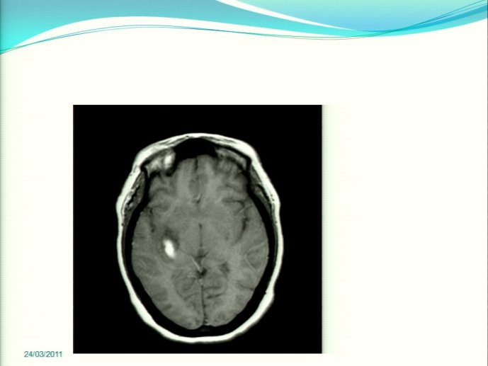 slide_0031_full