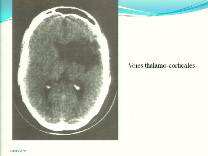 slide_0033_full
