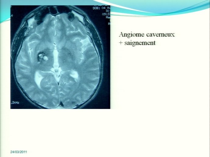 slide_0039_full