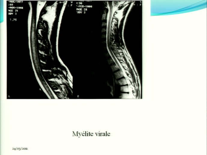slide_0045_full