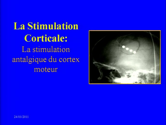 slide_0105_full