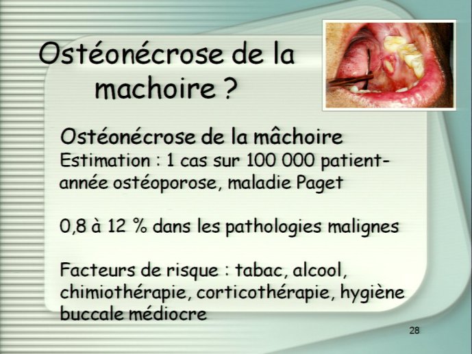slide_0081_full