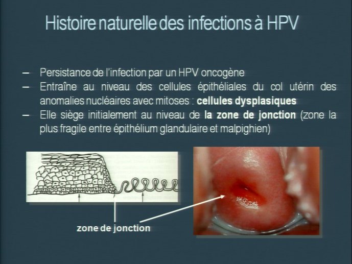 slide_0105_full