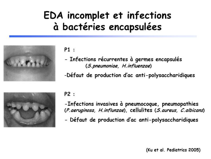 Diapositive35