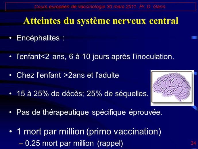 Diapositive34