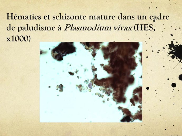 Diapositive34