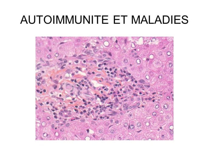 Diapositive9