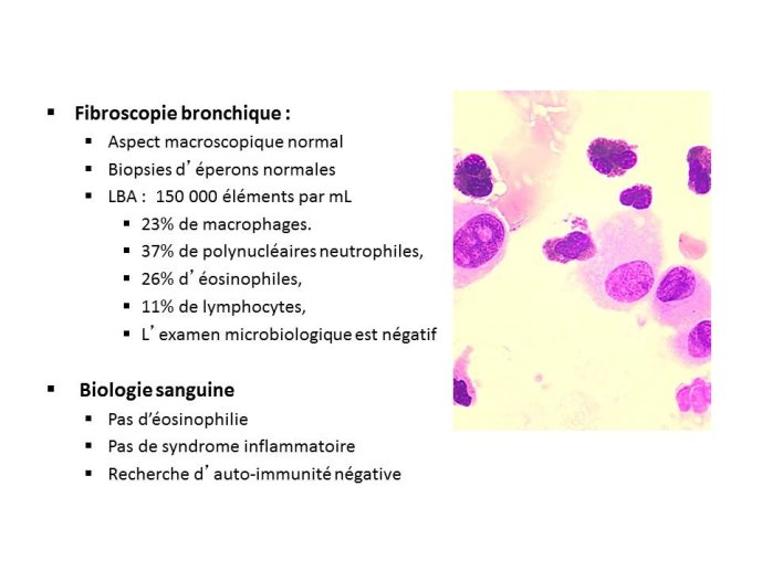 Diapositive9