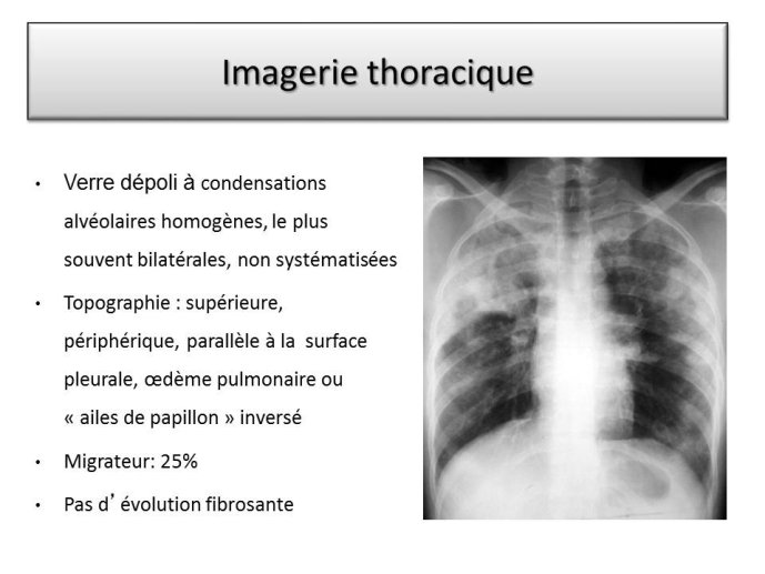 Diapositive17