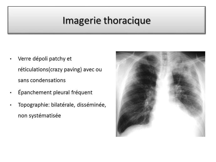 Diapositive38