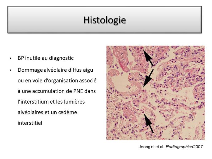 Diapositive41