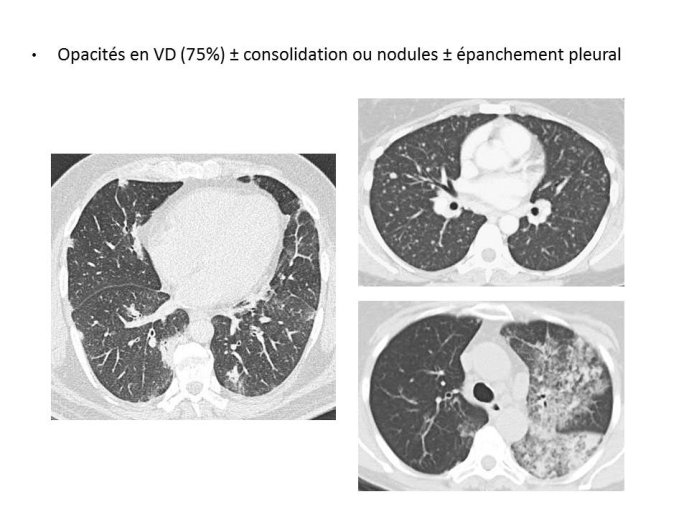 Diapositive47