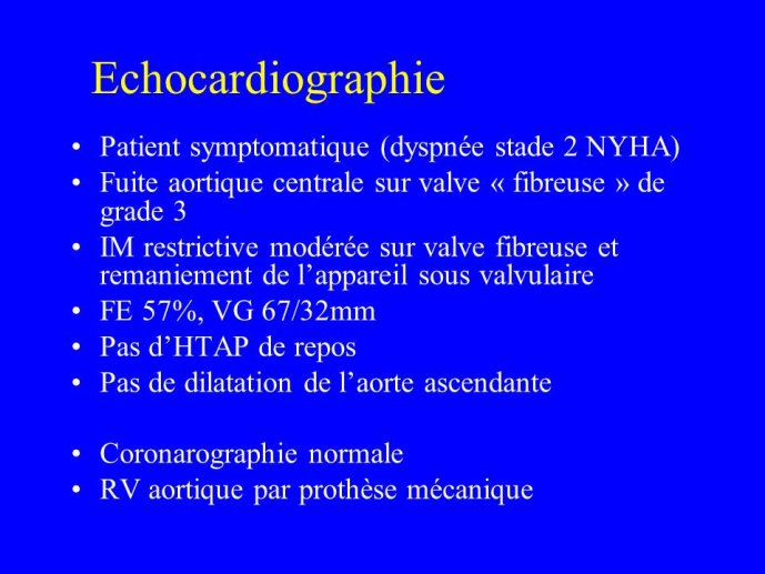 Diapositive14