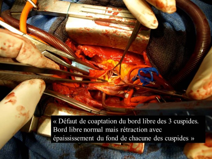 Diapositive15