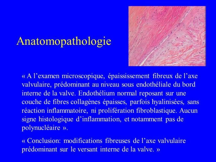 Diapositive16