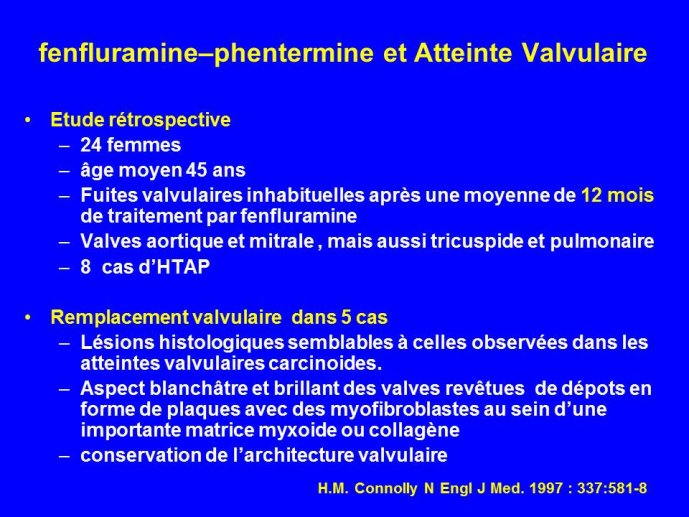 Diapositive19