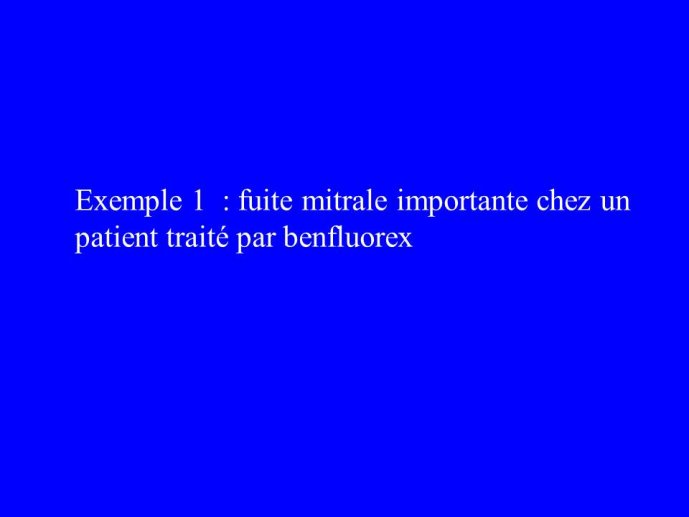 Diapositive38