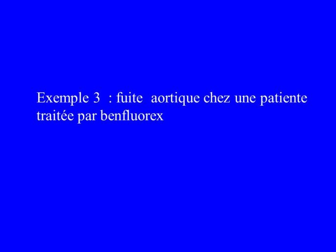 Diapositive43