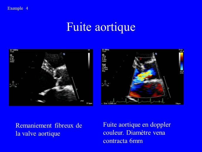 Diapositive48