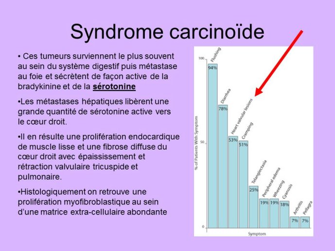 Diapositive16