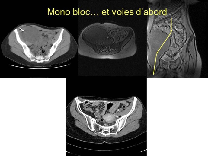 Diapositive32