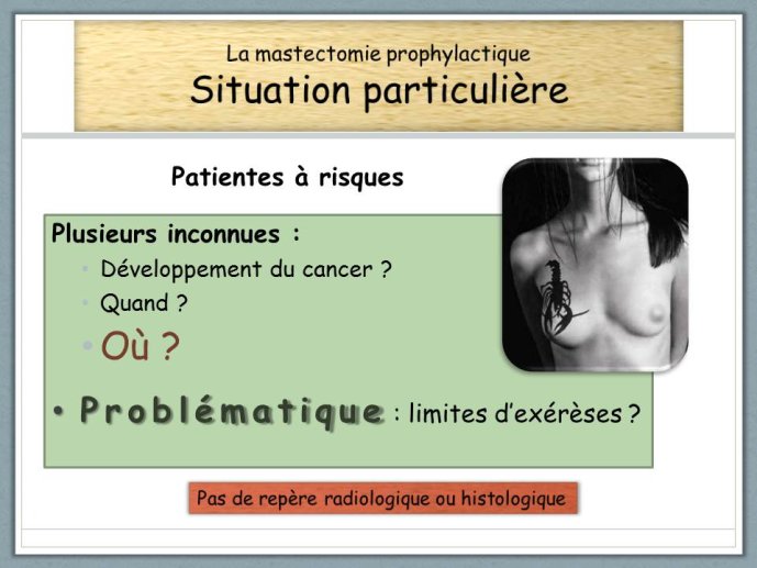 Diapositive2