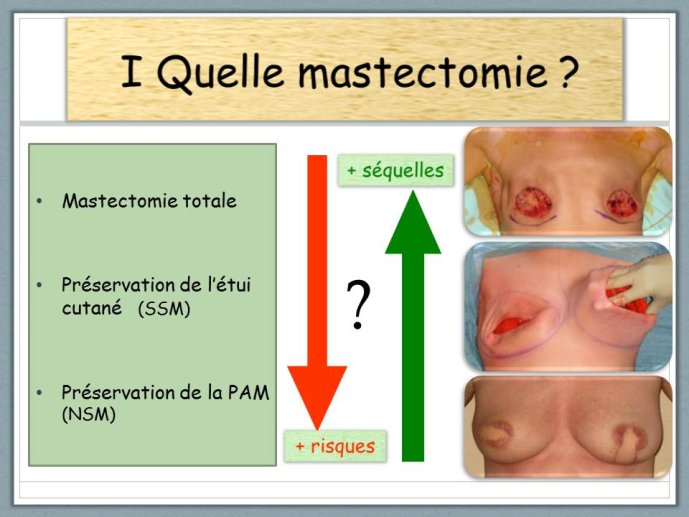 Diapositive6