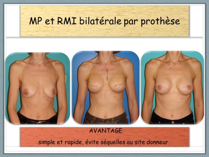Diapositive12