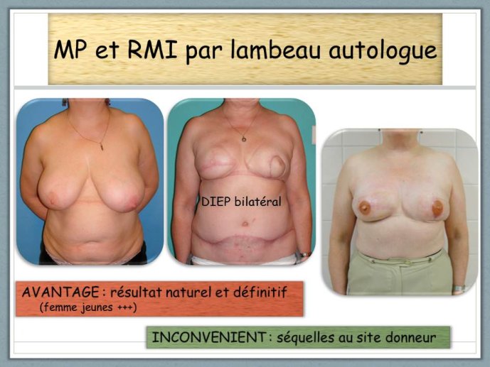 Diapositive14