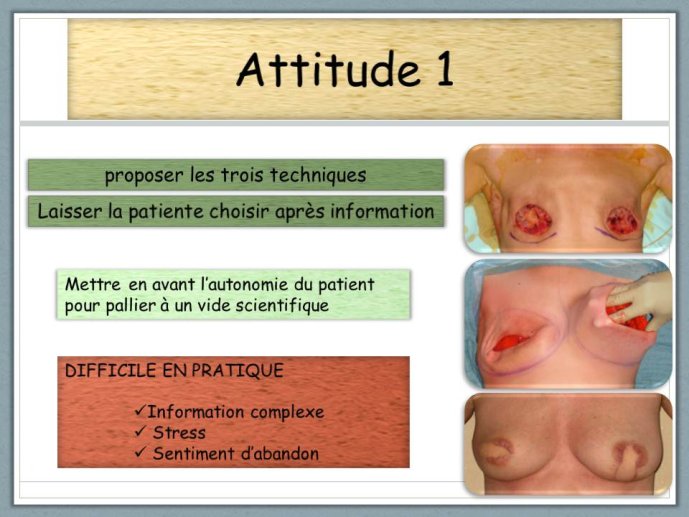 Diapositive24