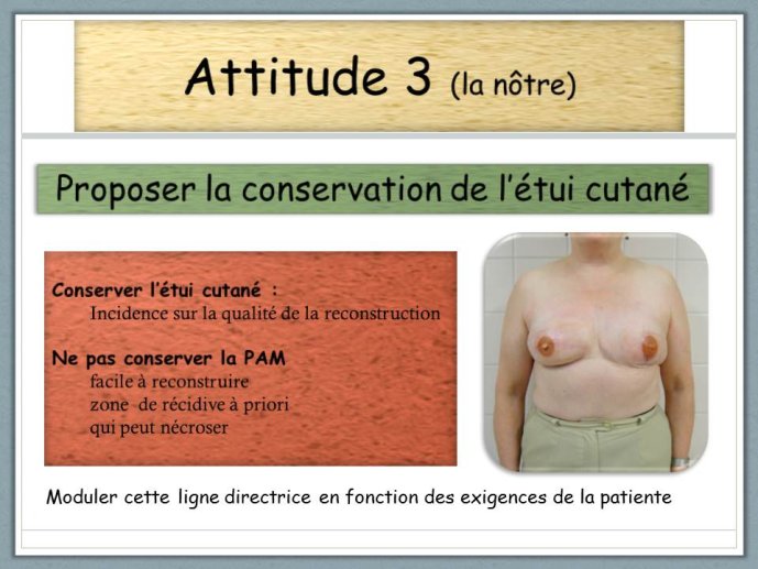 Diapositive26