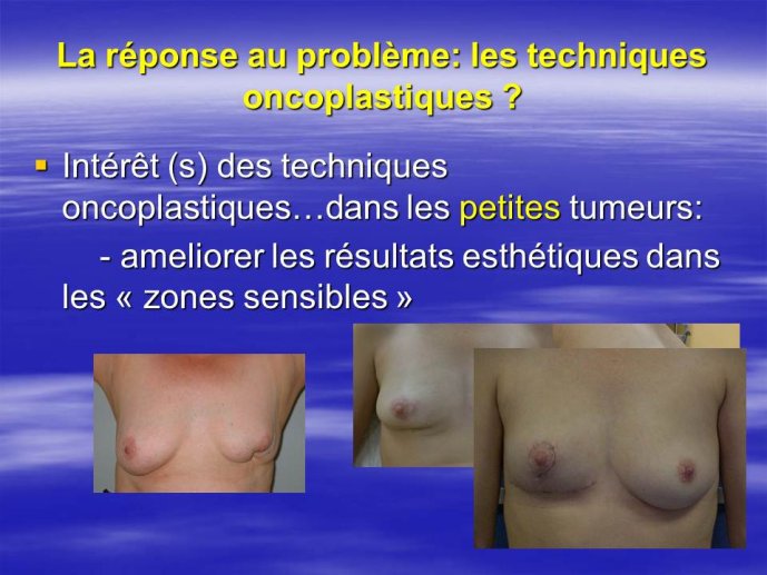 Diapositive22