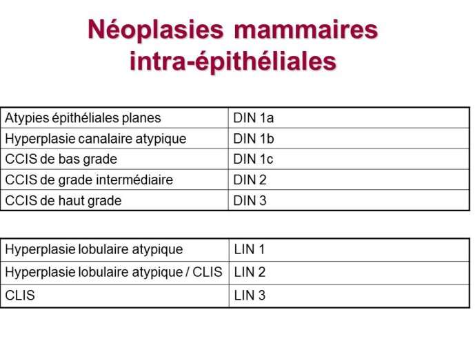 Diapositive14