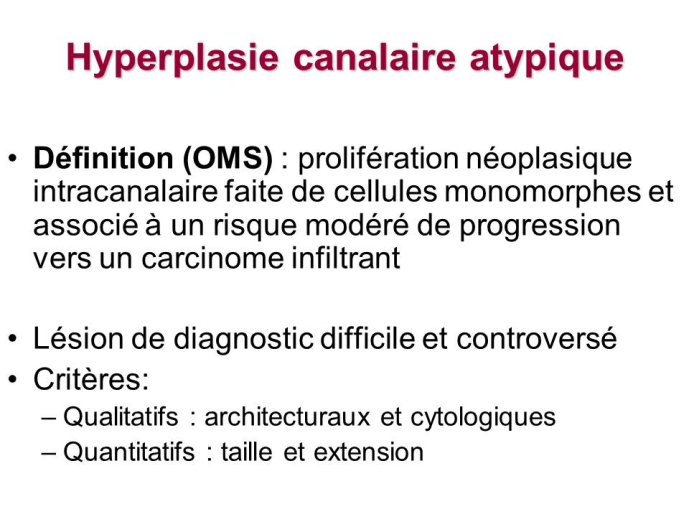 Diapositive19