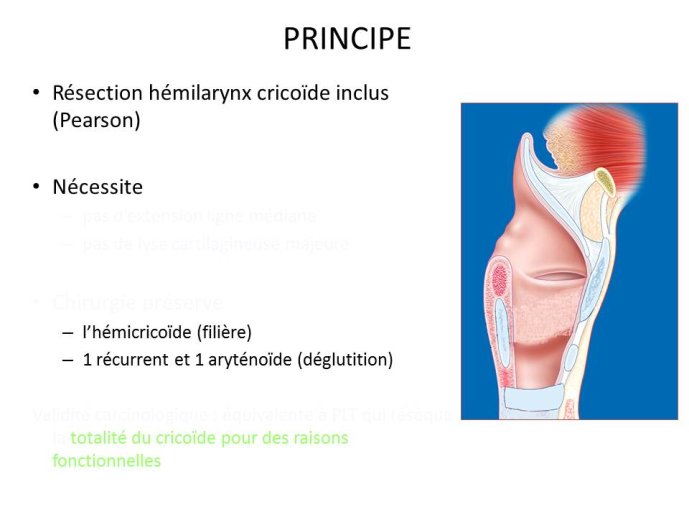 Diapositive95