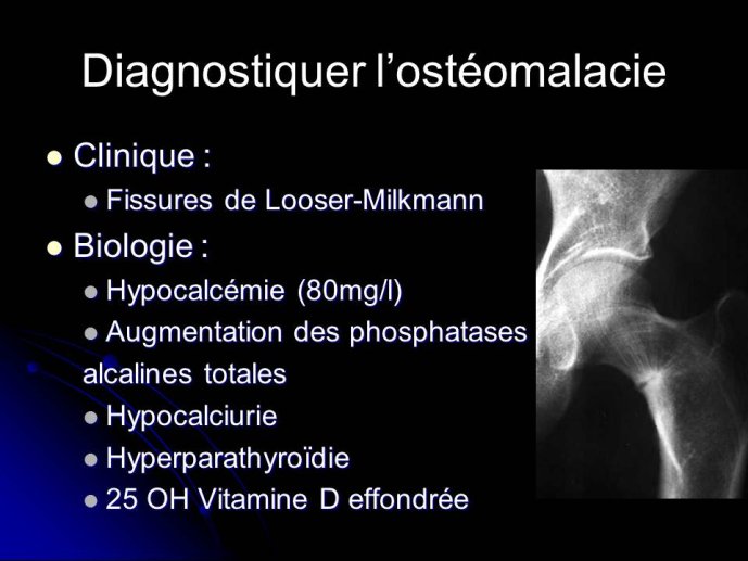 Diapositive22