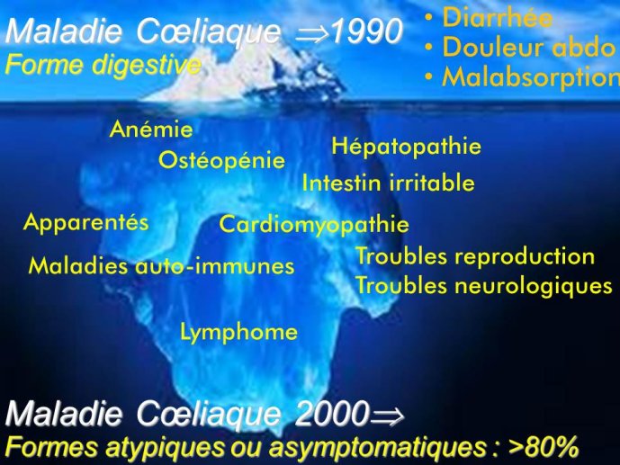 Diapositive34
