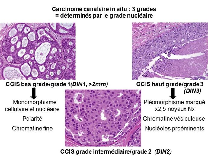 Diapositive21