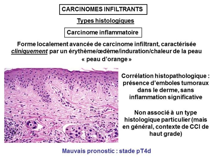 Diapositive36