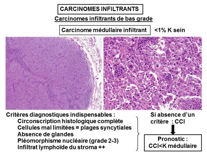 Diapositive41