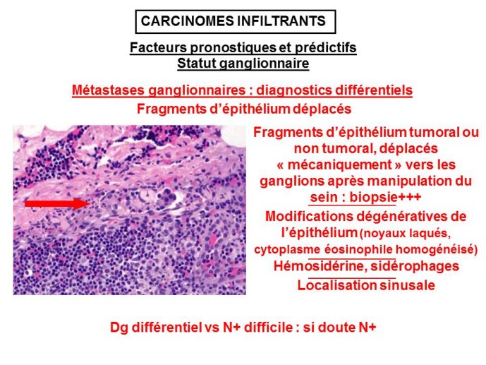 Diapositive54